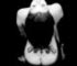 chirurgia estetica glutei
