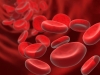 vena varicose